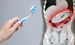 İlginç olay! Zayıflamak isterken diş fırçasını yuttu